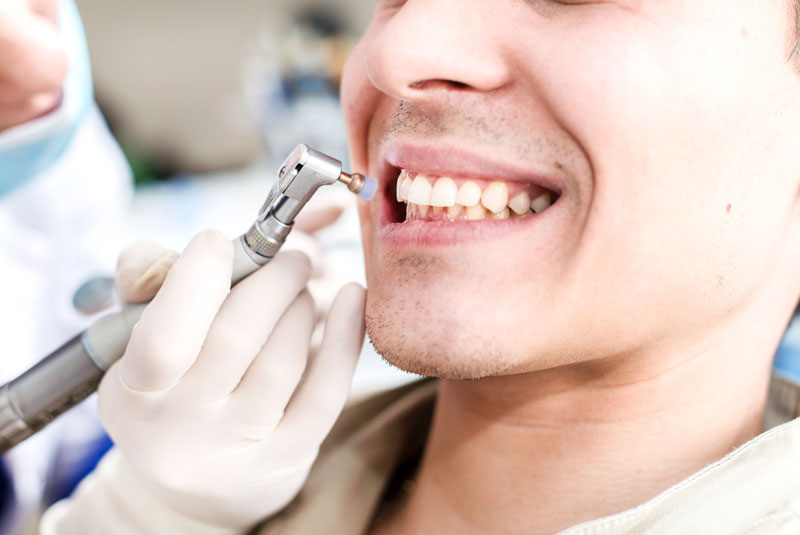 Cleaning Procedure