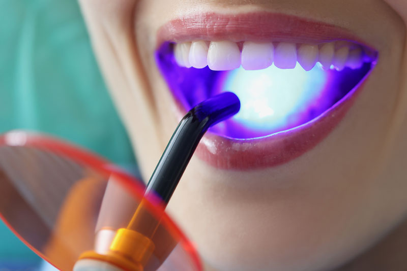 a patient receiving periodontal dental treatment using laser dentistry.