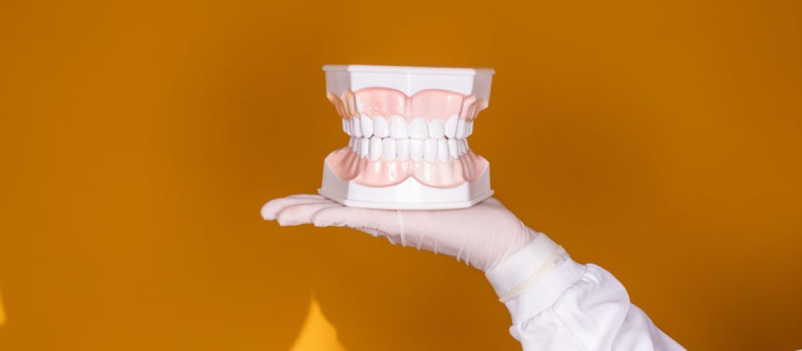 a full mouth dental implant model held up by a dentist.