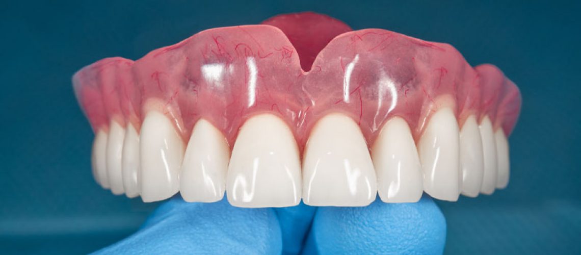 Full Dentures Graphic