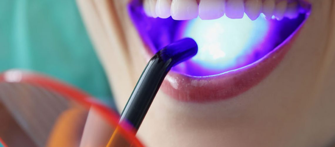 a patient receiving periodontal dental treatment using laser dentistry.